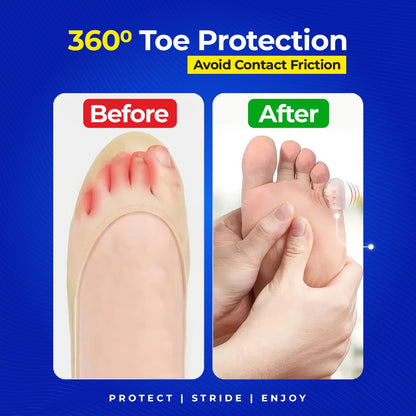 Silicone Anti-Pain Toe Protector